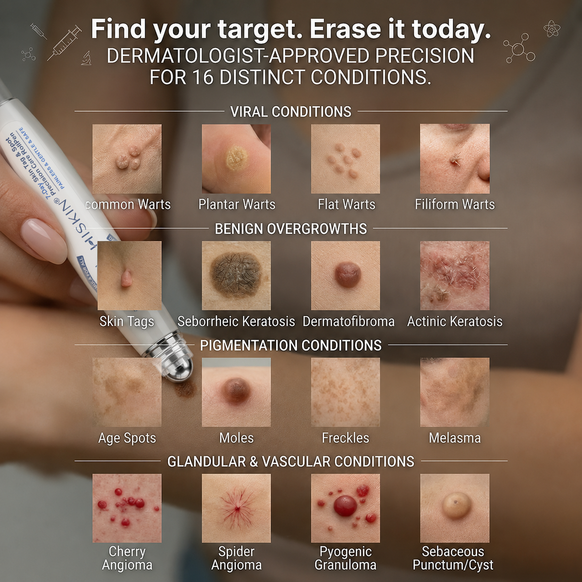 𝐇𝐈𝐒𝐊𝐈𝐍®👩‍⚕️ 𝟕-𝐃𝒂𝘆 𝐒𝗸𝐢𝐧 𝐓𝒂𝗴 & 𝐒𝐩𝙤𝐭 𝐄𝐫𝒂𝐬𝙚𝐫 Sans douleur & Scar-Free Advanced Imperfection Removal Rollerbtous Pen