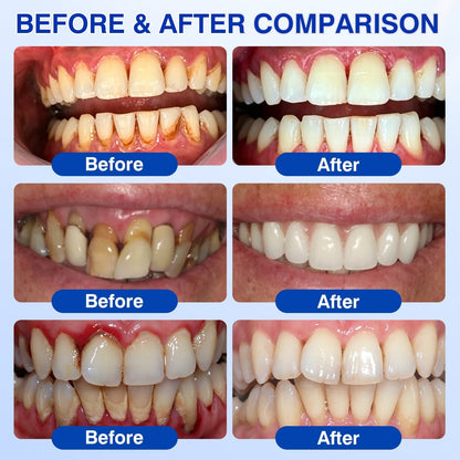 𝐇𝐈𝐒𝐊𝐈𝐍®👩‍⚕️🇺🇸🏅🦷🛡️HISKIN® GumRevive Periodontal Repair Gel