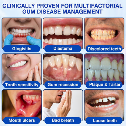 𝐇𝐈𝐒𝐊𝐈𝐍®👩‍⚕️🇺🇸🏅🦷🛡️HISKIN® GumRevive Periodontal Repair Gel