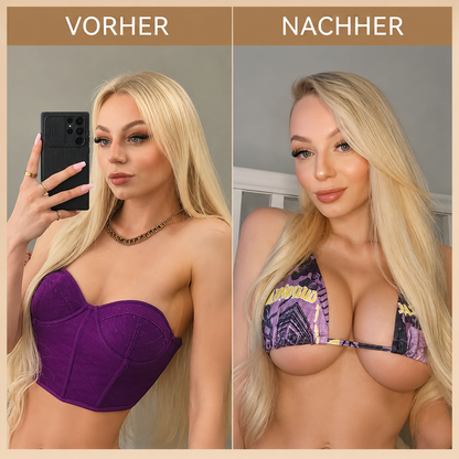❤️ Breast Firming👩‍⚕️ & Fuller-Looking Curves HISKIN® — Advanced Nano-Microneedle Patch for Targeted Care -1