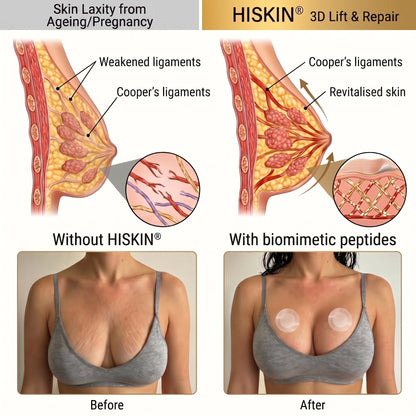 ❤️ Breast Firming👩‍⚕️ & Fuller-Looking Curves HISKIN® — Advanced Nano-Microneedle Patch for Targeted Care -1