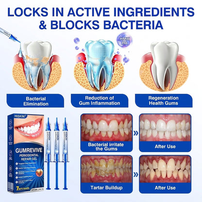 𝐇𝐈𝐒𝐊𝐈𝐍®👩‍⚕️🇺🇸🏅🦷🛡️HISKIN® GumRevive Periodontal Repair Gel