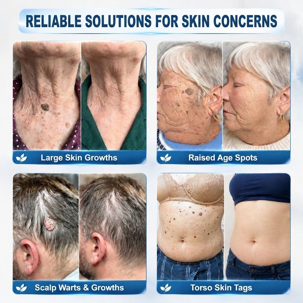 𝐇𝐈𝐒𝐊𝐈𝐍®👩‍⚕️ 𝟕-𝐃𝒂𝘆 𝐒𝗸𝐢𝐧 𝐓𝒂𝗴 & 𝐒𝐩𝙤𝐭 𝐄𝐫𝒂𝐬𝙚𝐫 Sans douleur & Scar-Free Advanced Imperfection Removal Rollerbtous Pen