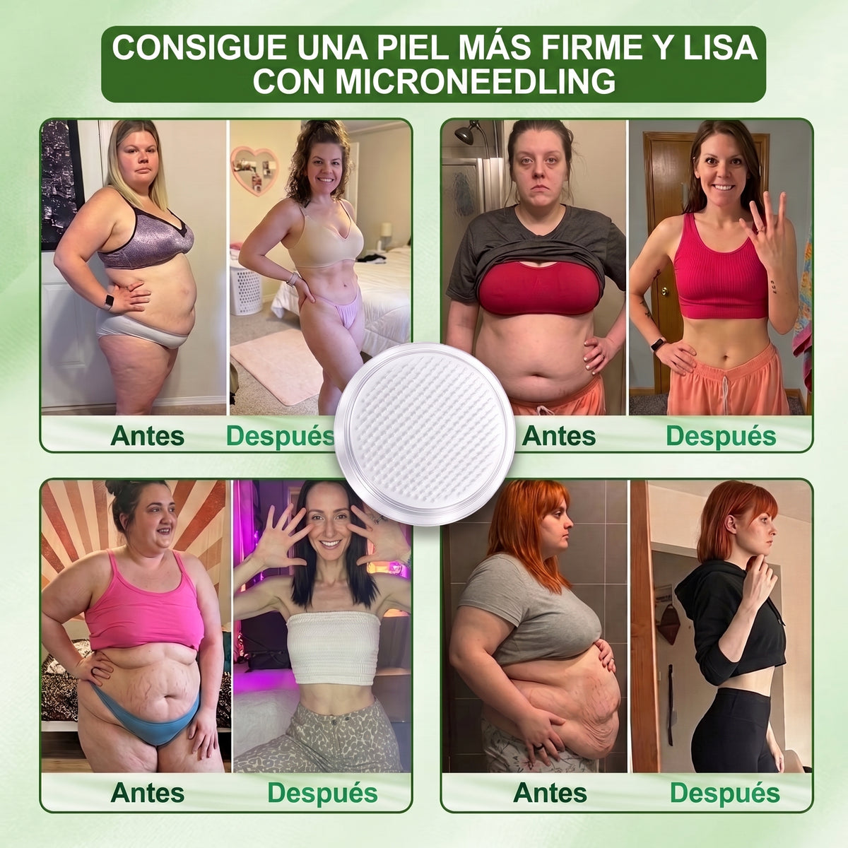 🦬[𝟐𝟎𝟐𝟔 𝐍𝐮𝐞𝐯𝐨: 𝟖𝟎 % 𝐃𝐄 𝐃𝐄𝐒𝐂𝐔𝐄𝐍𝐓𝐎] 👑 Solaroza® 𝐏𝐚𝐫𝐜𝐡𝐞 𝐍𝐚𝐧𝐨-𝐌𝐢𝐜𝐫𝐨𝐚𝐠𝐮𝐣𝐚𝐬 𝟓× — 𝐀𝐩𝐨𝐲𝐚 𝐥𝐚 𝐏é𝐫𝐝𝐢𝐝𝐚 𝐝𝐞 𝐏𝐞𝐬𝐨, 𝐞𝐥 𝐃𝐫𝐞𝐧𝐚𝐣𝐞 𝐋𝐢𝐧𝐟á𝐭𝐢𝐜𝐨, 𝐥𝐚𝐬 𝐀𝐫𝐭𝐢𝐜𝐮𝐥𝐚𝐜𝐢𝐨𝐧𝐞𝐬, 𝐞𝐥 𝐒𝐮𝐞ñ𝐨 𝐲 𝐥𝐚 𝐂𝐥𝐚𝐫𝐢𝐝𝐚𝐝 𝐌𝐞𝐧𝐭𝐚𝐥.